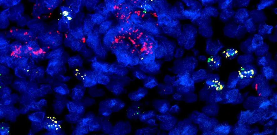 Вчені виявили новий тип імунної клітини