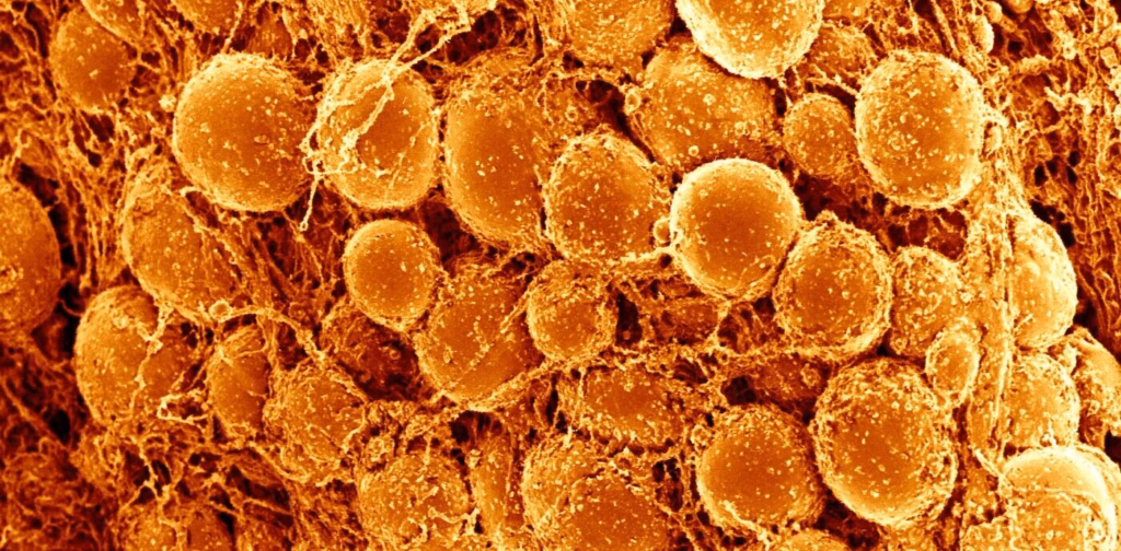 Активація бурого жиру може подовжити життя та покращити фізичну форму