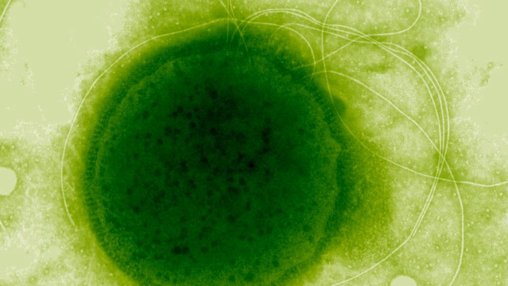 Цей надстійкий до радіації організм еволюціонував у дивовижну форму виживання